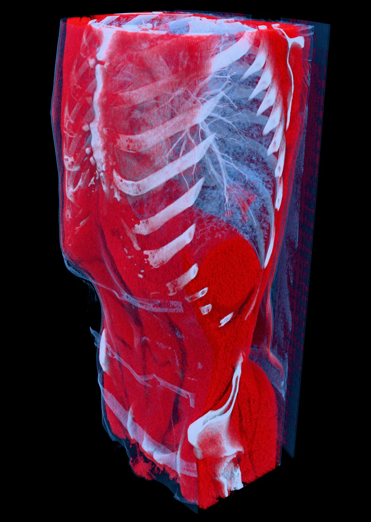 MECANIX torso CT scan rendered in 3D showing lungs ribs and soft tissue